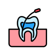 RCT (Root Canal)