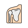 Highlights of Shoulder Replacement
