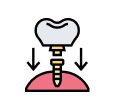 Artificial Teeth Implant